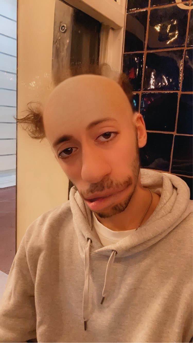 Hugo
